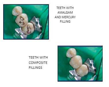 FOTO BIO DENTESTRY I FOTO BIO DENTESTRY I